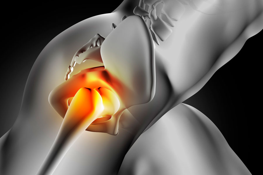 dolor cadera al correr anatomia estructuras 02